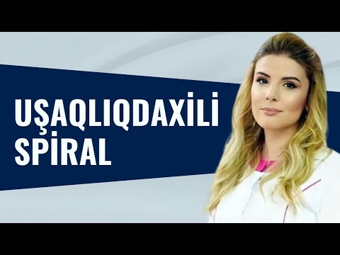 Hansı qadınlara spiral məsləhət deyil?