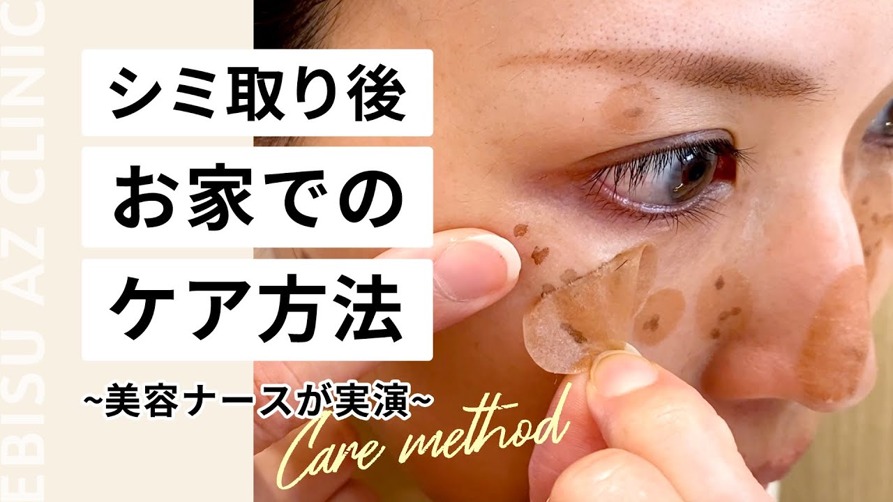 【シミ取りレーザー】アフターケア手順【恵比寿アズクリニック】