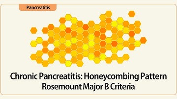 Linear EUS: Chronic Pancreatitis: Honeycombing Pattern