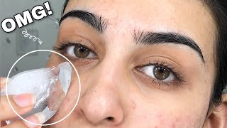 One Week Of ICE CUBE On My Face *SHOCKING RESULTS*
