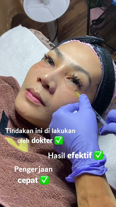 HILANGKAN LEMAK PADA KANTUNG MATA ? LETS GO TREATMENT INI #lemakbawahmata #lemak #treatment #klinikk