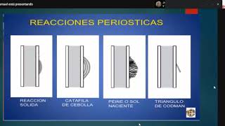 Benign Bone Tumors
