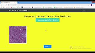 Breast Cancer Detection CNN Train Flask App in Python Projects