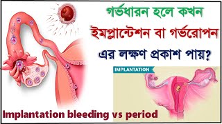 Implantation symptoms. Implantation bleeding vs period , how to know the difference.