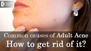 Common causes of Adult Acne and How to get rid of it? - Dr. Rasya Dixit