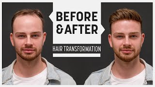 Hair piece despite full hair? (amazing hair loss cover up) | Transformation Hubi