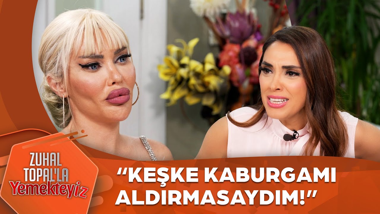 Pınar'ın Pişman Oludğu Estetiği! | Zuhal Topal'la Yemekteyiz 803. Bölüm