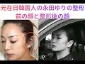 【アホン人に人気】元在日韓国人の永田ゆりの整形前の顔と整形後の顔。#永田ゆり、#韓国系アメリカ人の永田ゆり