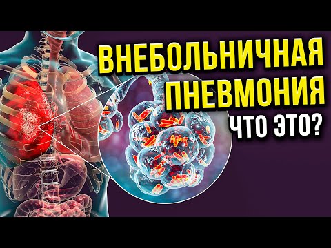 Что такое "Внебольничная Пневмония"? Как её опредилить?