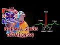 EKG - SİNÜS RİTMLERİ : Normal Sinüs Ritmi