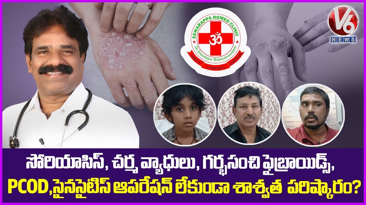 Eshwarappa Homeo Clinic - All Type Of Diseases Will Be Cured | Dandepu Baswanandam | V6 News