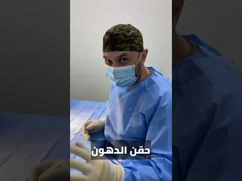 ماهي العضلة النائمة او ما ي عرف بـ الخفسات وكيف يتم علاجها