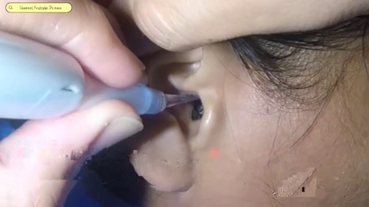 EARクリーニングEP1 YouTube