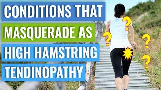 Conditions that Masquerade as High Hamstring Tendinopathy