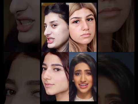 شكل المشاهير قبل الشهرة