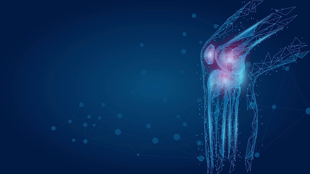 Providence St. Joseph Hospital: MAKOplasty