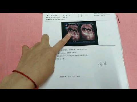 小孕妇今天暴露了胎儿B超同时也暴露了自己的名字