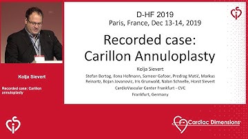 Kolja Sievert presents a Live Case of annuloplasty with the Carillon System | CSI D-HF Paris 2019