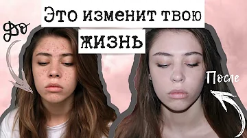 КАК ИЗБАВИТЬСЯ от ПРЫЩЕЙ и ПЯТЕН от НИХ ♥ ПОСТАКНЕ