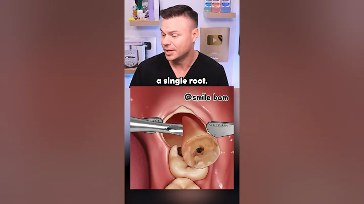 What REALLY Happens During Wisdom Teeth Removal! 🦷😯