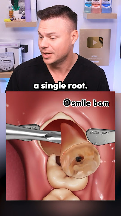 What REALLY Happens During Wisdom Teeth Removal! 🦷😯