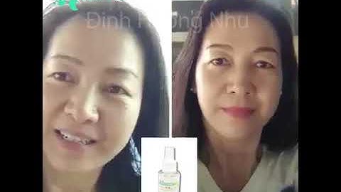 Hói đầu , rụng tóc nhiều thì phải làm sao? Xem ngay