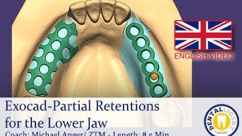 ENGLISH TUTORIAL - Exocad-Partial Retentions for the Lower Jaw