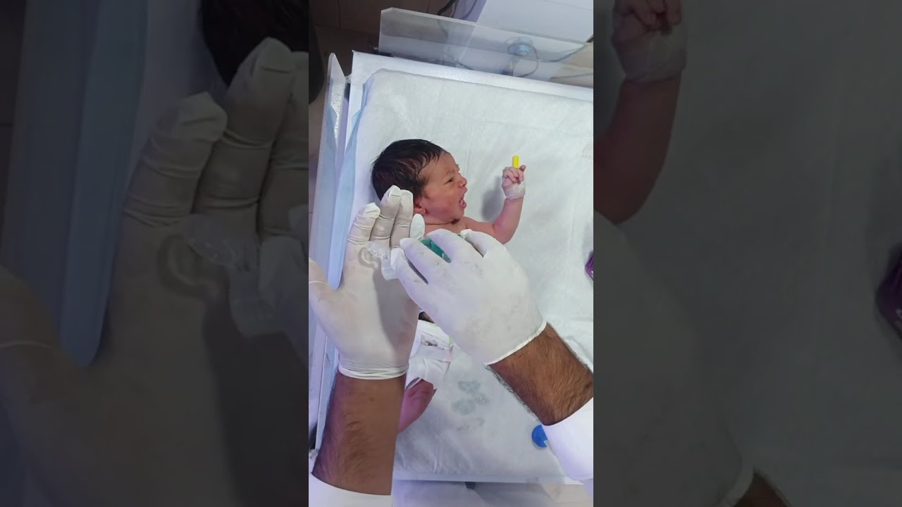 How to Manage Poor Suck in a Newborn | Feeding Trial, Initial Assessment & only For Education Video