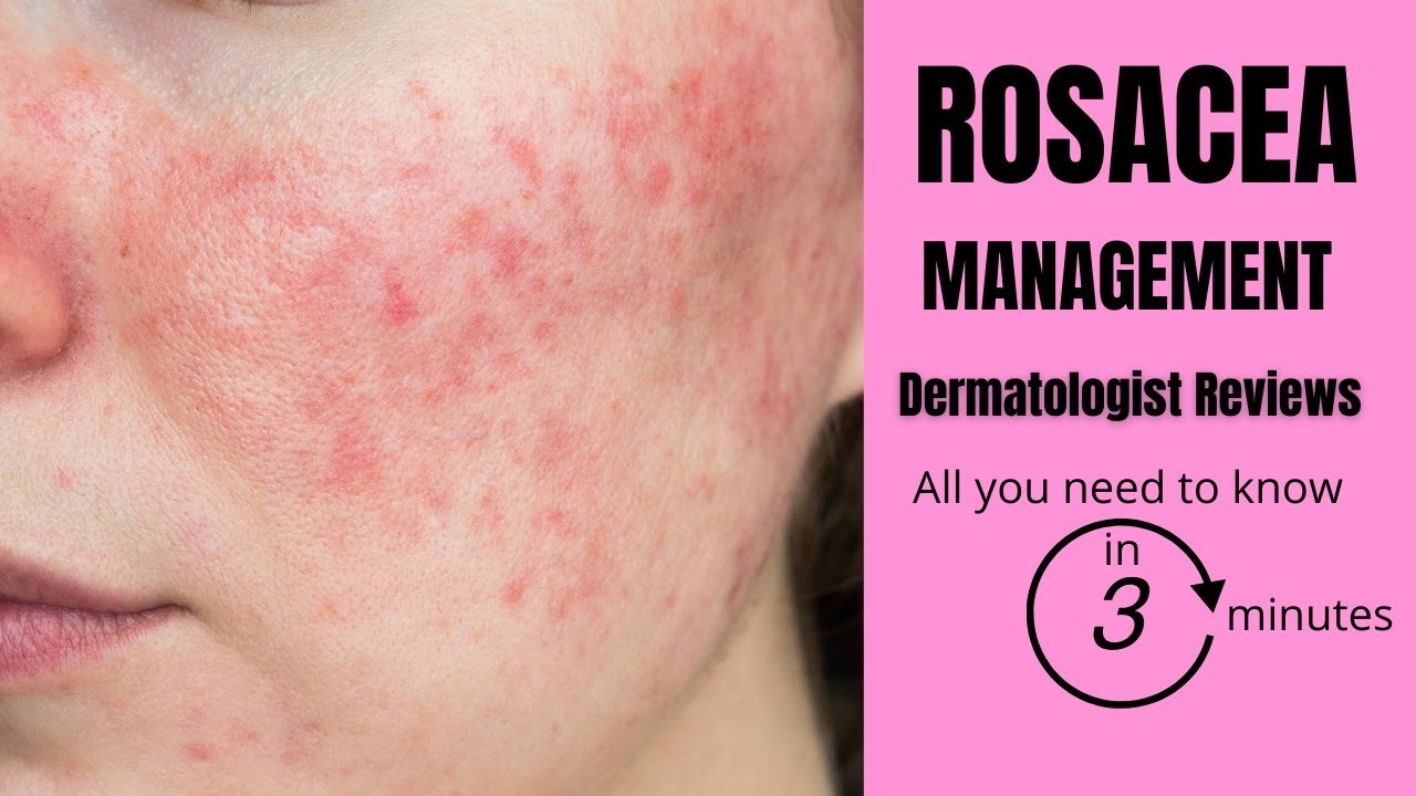 fersken Sicilien bilag Professional Rosacea Skin Care In Australia | Dr Davin Lim