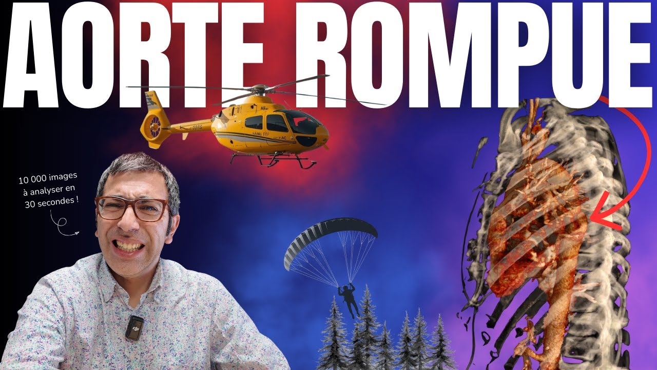 Crash en parapente : le scanner révèle une BOMBE à retardement