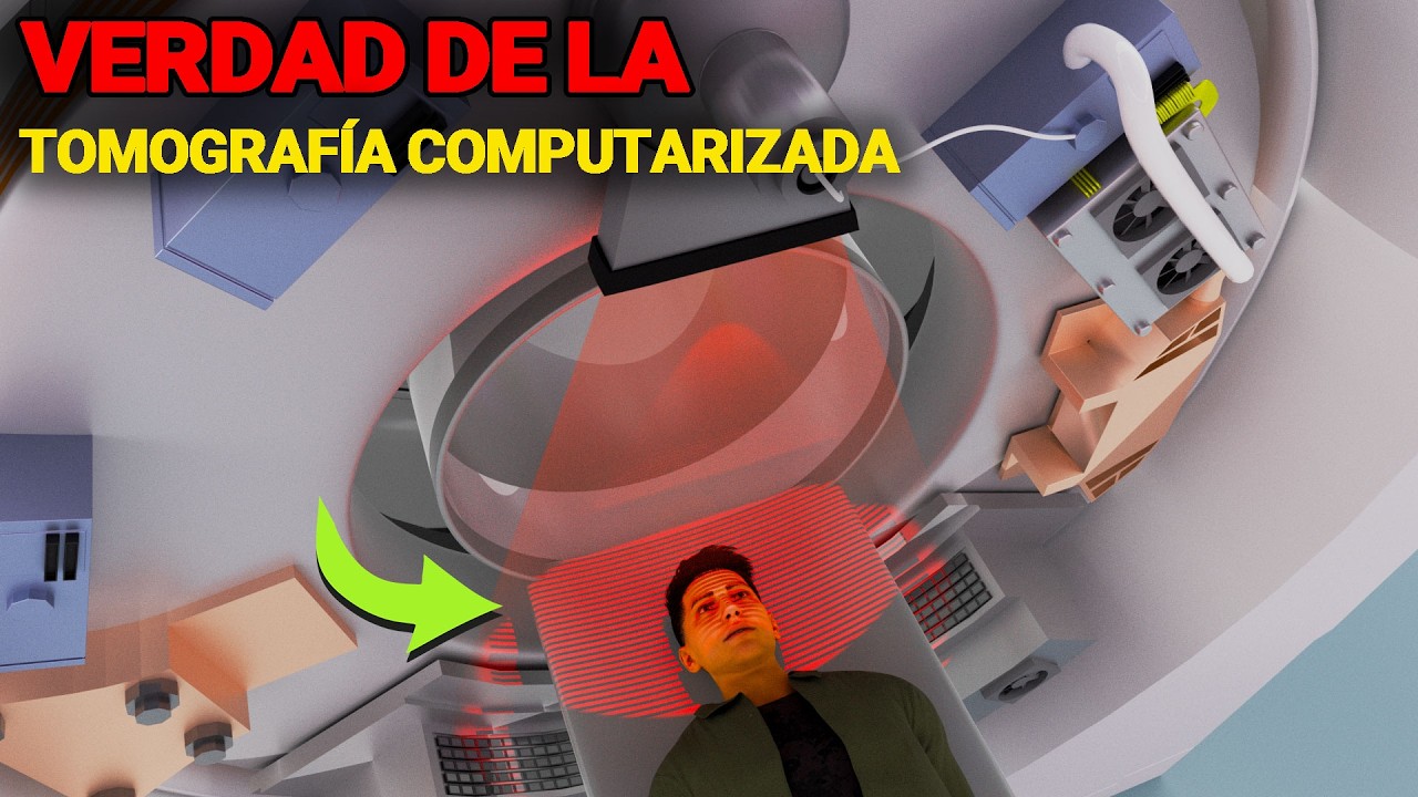 Cómo funciona una máquina de tomografía computarizada: animación 3D | Principios y tecnología