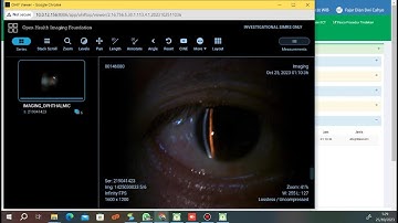 SLIT LAMP RIS PACS DICOM Web VIEWER SIMRS
