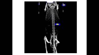 Asvide: Maximum intensity projection of an under the kidney capsule transplant 1 day after Tx