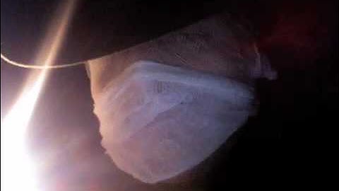 counterpoint-2 Induce Connect