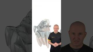 Aparat ortodontyczny czy nakładki – co działa szybciej? 🦷⏱️ Dentysta wyjaśnia