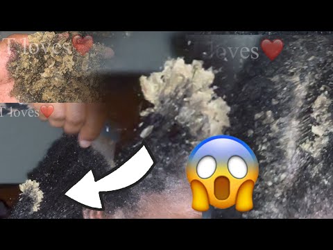 FULL HEAD OF FLAKES!!!😱 I wasn’t expecting this much!!!!!