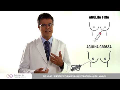 QUAL A MELHOR BIÓPSIA MAMÁRIA?