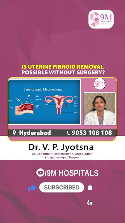 can-uterine-fibroids-be-removed-without-surgery-dr-v-p-jyotsna