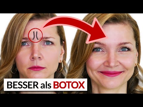 Video: Soll ich Make-up zu meiner Botox-Anwendung tragen?