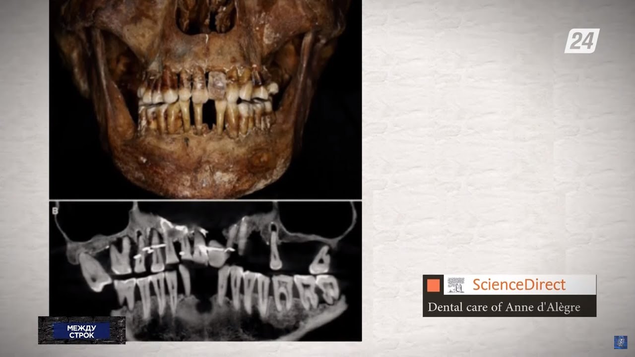 Археологи обнаружили золотые «брекеты» XVII века | Между строк - YouTube