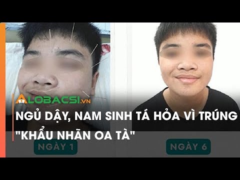 Video Ngủ dậy, nam sinh tá hỏa vì trúng 