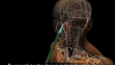Interactive Motion Planning for Concentric Tube Robots