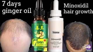 This Formula really Works HIMS MINOXIDIL vs 7 DAYS GINGER oil