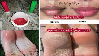 مرطب مورد الشفاه?احمر شفاه?كريم طبيعي يرطب ويعالج تشقق القدمين✔️ودعي جفاف وتقشر الرجلين فقط في البيت