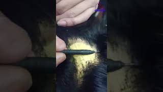 Watch How we Refilling this Hair Patch | Hair Patch In Delhi NCR | 8800879229 | 8800269214