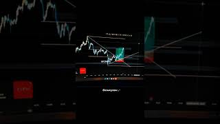 What's Going On In Your Mind 24/7...? 📈 Only Traders Will Understand 💸 | Trading Motivation #shorts