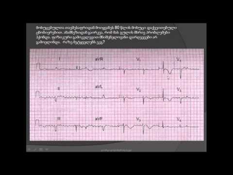 ამიოდარონი, წინაგულების თრთოლვა, პარკუჭოვანი ექსტრასისტოლია, გახანგრძლივებული QT ინტერვალი,ჰემიბლოკი