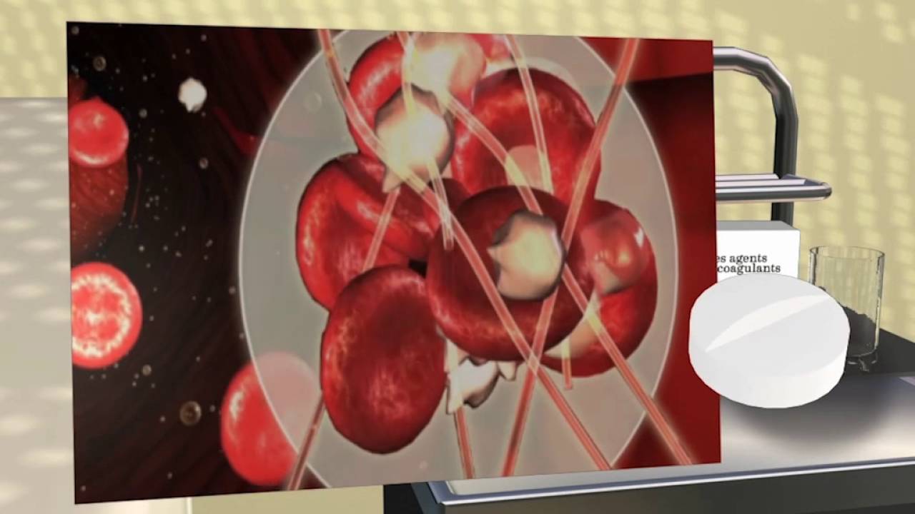 Cardiologie - Prendre un traitement anticoagulant