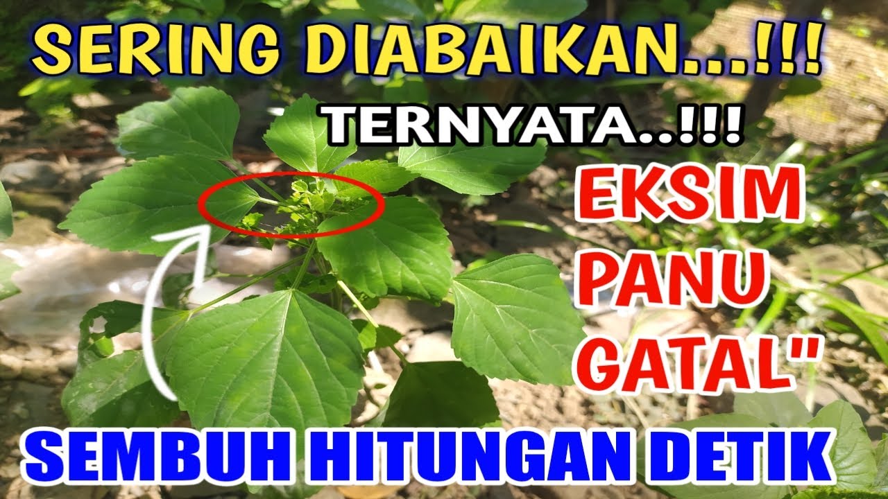 SANGAT AMPUH!!Cara mengobati EKSIM kering dengan cepat, Obat EKSIM