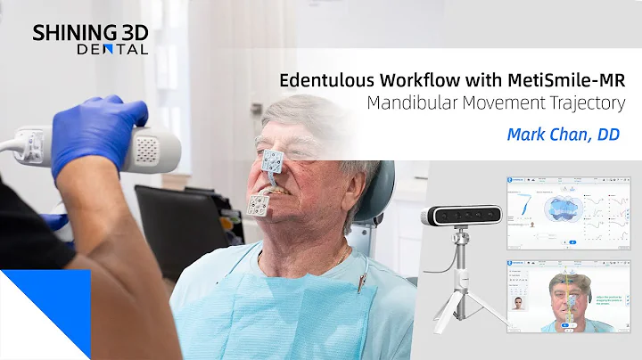 Digital Denture Workflow for Edentulous Patients-SHINING 3D MetiSmile MR & Aoralscan Elite Wireless